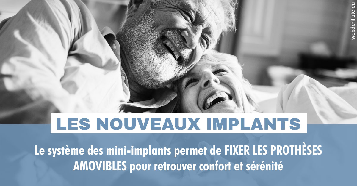 https://dr-virapin-apou-jeanmarc.chirurgiens-dentistes.fr/Les nouveaux implants 2