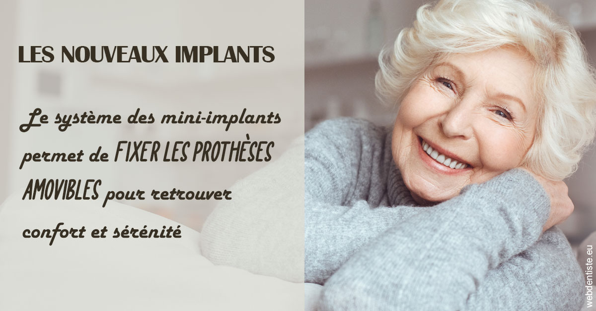 https://dr-virapin-apou-jeanmarc.chirurgiens-dentistes.fr/Les nouveaux implants 1