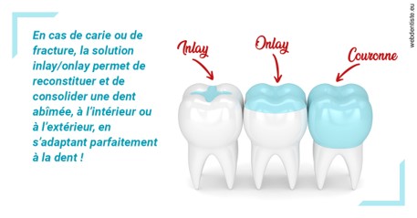 https://dr-virapin-apou-jeanmarc.chirurgiens-dentistes.fr/L'INLAY ou l'ONLAY