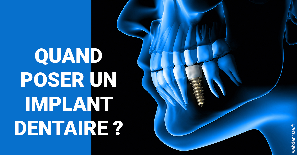 https://dr-virapin-apou-jeanmarc.chirurgiens-dentistes.fr/Les implants 1