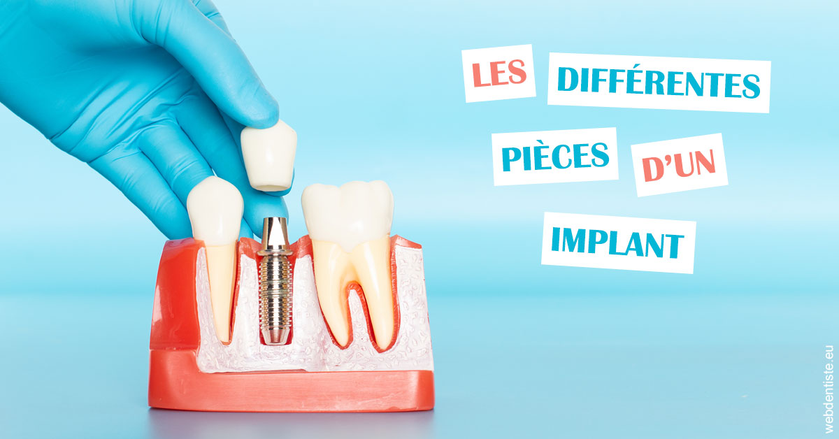 https://dr-virapin-apou-jeanmarc.chirurgiens-dentistes.fr/Les différentes pièces d’un implant 2