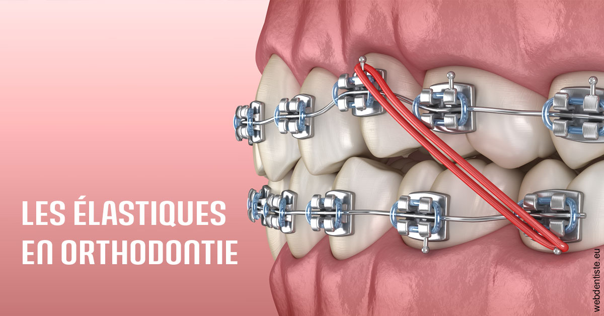 https://dr-virapin-apou-jeanmarc.chirurgiens-dentistes.fr/Elastiques orthodontie 2
