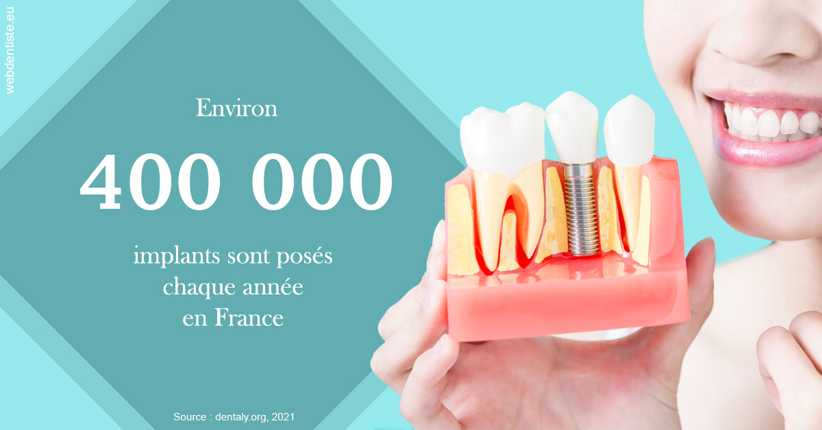 https://dr-virapin-apou-jeanmarc.chirurgiens-dentistes.fr/Pose d'implants en France 2